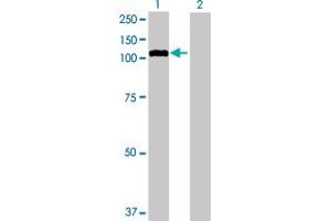 Image no. 1 for anti-Glucosidase, Alpha, Neutral C (GANC) (AA 1-914) antibody (ABIN515922)