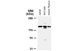 Image no. 3 for anti-Apoptotic Peptidase Activating Factor 1 (APAF1) antibody (ABIN957135)