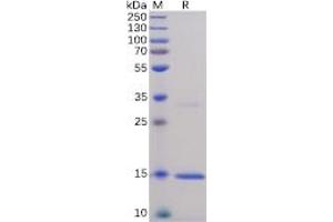 Human TNFα Protein, His Tag on SDS-PAGE under reducing condition.