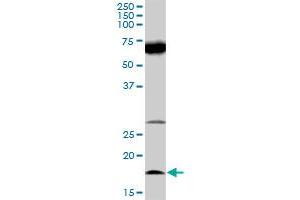 Image no. 4 for anti-Interleukin 21 (IL21) (AA 1-162) antibody (ABIN528381)