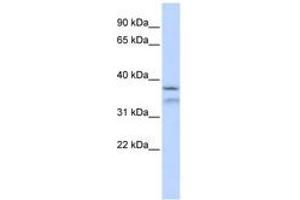 Image no. 1 for anti-Hydrolethalus Syndrome 1 (HYLS1) (AA 216-265) antibody (ABIN6743836)