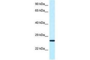 NUDT16 Antikörper  (AA 45-94)