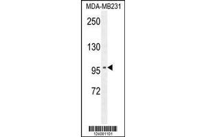 Image no. 1 for anti-Suppression of Tumorigenicity 7 (ST7) (AA 169-197) antibody (ABIN654450)