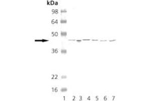 PKA anticorps