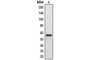 Image no. 1 for anti-Cytochrome P450, Family 2, Subfamily A, Polypeptide 7 (CYP2A7) (C-Term) antibody (ABIN2704697)