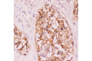 Image no. 5 for anti-V-Crk Sarcoma Virus CT10 Oncogene Homolog (Avian) (CRK) (AA 2-246) antibody (ABIN3042758)