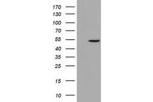 anti-U2AF Homology Motif (UHM) Kinase 1 (UHMK1) antibody