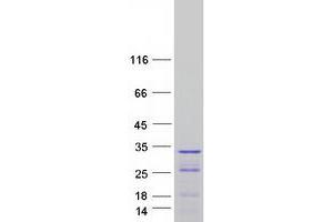 Image no. 1 for Protein Phosphatase 1, Regulatory Subunit 12B (PPP1R12B) (Transcript Variant 4) protein (Myc-DYKDDDDK Tag) (ABIN2729470)