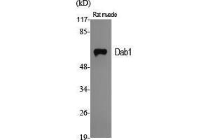 Image no. 2 for anti-Disabled Homolog 1 (Drosophila) (DAB1) (Ser296) antibody (ABIN3184244)