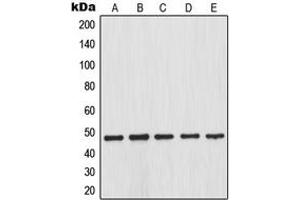 Image no. 3 for anti-Inhibitor of kappa Light Polypeptide Gene Enhancer in B-Cells, Kinase beta (IKBKB) (N-Term), (pSer23) antibody (ABIN2707591)