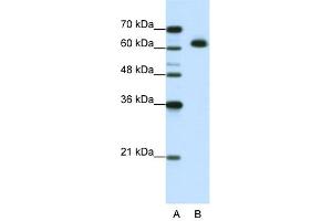 Image no. 1 for anti-DIS3-Like Exonuclease 2 (DIS3L2) (N-Term) antibody (ABIN2776648)