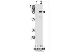Image no. 2 for anti-Protein Kinase C, eta (PRKCH) (AA 210-239), (N-Term) antibody (ABIN391008)