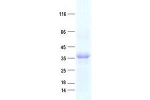 OVOL1 Protein (His tag)