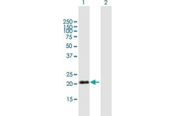 anti-Immunoglobulin J Polypeptide, Linker Protein For Immunoglobulin alpha and mu Polypeptides (IGJ) (AA 1-159) antibody
