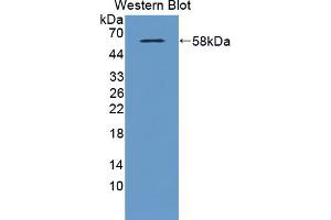 Image no. 2 for anti-Glutamate Receptor, Metabotropic 3 (GRM3) (AA 568-819) antibody (ABIN5013622)