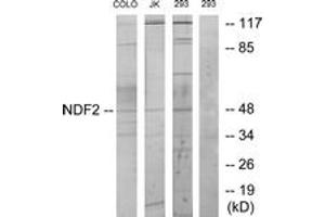 Image no. 1 for anti-Neurogenic Differentiation 2 (NEUROD2) (AA 61-110) antibody (ABIN1533925)