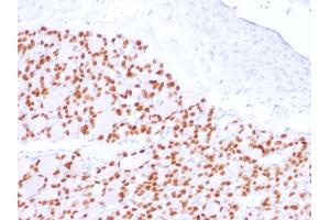 Image no. 3 for anti-Paired Box 8 (PAX8) (AA 60-261) antibody (ABIN6940927)
