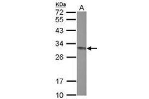 Image no. 2 for anti-ClpP Caseinolytic Peptidase, ATP-Dependent, Proteolytic Subunit Homolog (E. Coli) (CLPP) (AA 48-272) antibody (ABIN1497534)