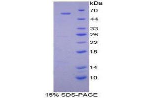 Image no. 1 for Cathepsin A (CTSA) (AA 215-470) protein (His tag,GST tag) (ABIN1877479)