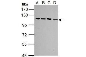Image no. 1 for anti-Squamous Cell Carcinoma Antigen Recognized By T Cells (SART1) (Internal Region) antibody (ABIN2855616)
