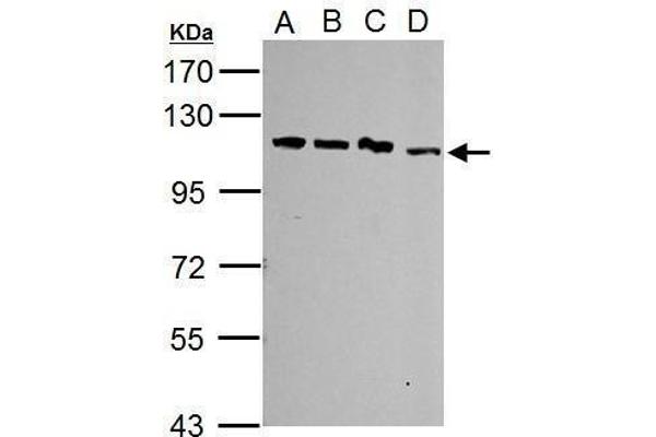 anti-Squamous Cell Carcinoma Antigen Recognized By T Cells (SART1) (Internal Region) antibody