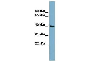 Image no. 1 for anti-Solute Carrier Family 35, Member D3 (SLC35D3) (N-Term) antibody (ABIN2781552)