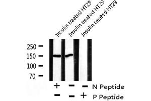 Image no. 1 for anti-Apoptotic Chromatin Condensation Inducer 1 (ACIN1) (pSer1180) antibody (ABIN6271640)
