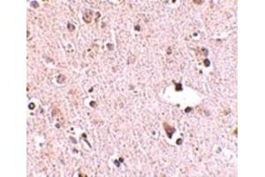Image no. 3 for anti-Polymerase (RNA) III (DNA Directed) Polypeptide F, 39 KDa (POLR3F) (N-Term) antibody (ABIN6656851)