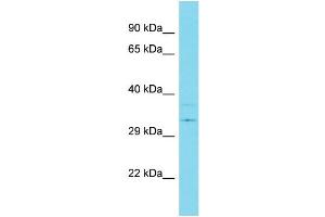 Image no. 1 for anti-Ubiquitin Specific Peptidase 39 (USP39) (C-Term) antibody (ABIN2780793)