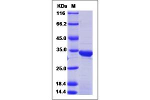 Image no. 1 for Dehydrogenase/reductase (SDR Family) Member 9 (DHRS9) (AA 18-319) protein (His tag) (ABIN2006452)