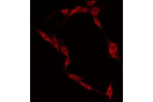 Image no. 1 for anti-CAP-GLY Domain Containing Linker Protein Family, Member 4 (CLIP4) (Internal Region) antibody (ABIN6259592)