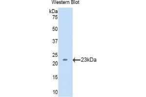 Image no. 1 for Lecithin-Cholesterol Acyltransferase (LCAT) ELISA Kit (ABIN6720598)