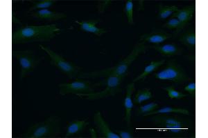 Image no. 4 for anti-Dystrobrevin alpha (DTNA) (AA 1-371) antibody (ABIN515088)