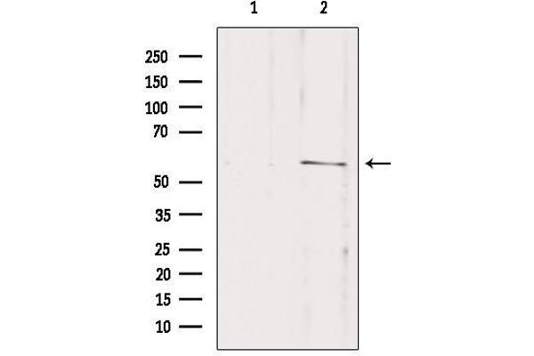 anti-Solute Carrier Family 16 Member 2 (SLC16A2) (Internal Region) antibody