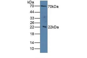IL1RAP 抗体  (AA 420-558)