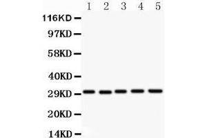 Image no. 4 for anti-CD82 (CD82) (AA 98-267) antibody (ABIN3043486)