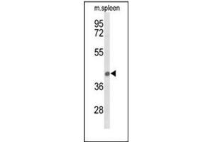 Image no. 1 for anti-Peroxisomal Biogenesis Factor 12 (PEX12) (AA 137-167), (Middle Region) antibody (ABIN954095)
