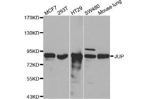Image no. 2 for anti-Junction Plakoglobin (JUP) antibody (ABIN3021168)