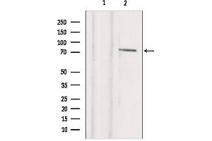 Image no. 2 for anti-T-Box 2 (TBX2) antibody (ABIN6265488)