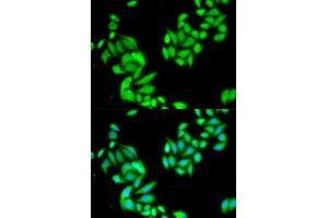 Image no. 3 for anti-Inhibitor of kappa Light Polypeptide Gene Enhancer in B-Cells, Kinase beta (IKBKB) antibody (ABIN3022876)