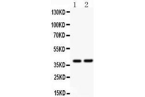 Image no. 1 for anti-SRY (Sex Determining Region Y)-Box 1 (SOX1) (AA 215-248), (Middle Region) antibody (ABIN3043439)