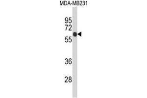 Image no. 1 for anti-Ankyrin Repeat Domain 13C (ANKRD13C) (AA 1-30), (N-Term) antibody (ABIN950420)