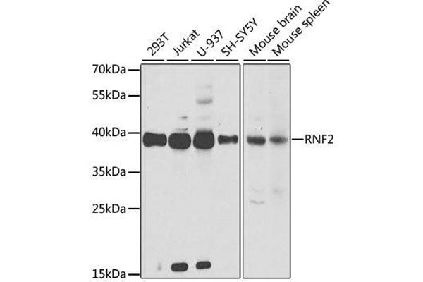 anti-Ring Finger Protein 2 (RNF2) antibody
