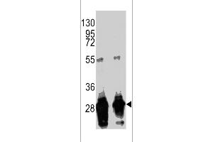 Western blot analysis of anti-GFP Tag Antibody (Ascites) (CA071114E) in GFP recombinant protein.