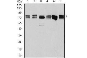 Image no. 4 for anti-DEAD (Asp-Glu-Ala-Asp) Box Polypeptide 3, X-Linked (DDX3X) (AA 518-661) antibody (ABIN5542508)