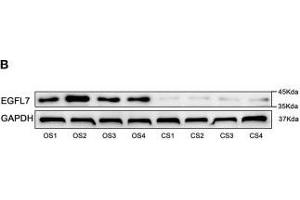 Image no. 4 for anti-Glyceraldehyde-3-Phosphate Dehydrogenase (GAPDH) antibody (ABIN3020541)