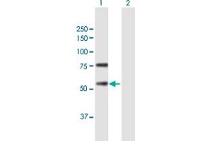 Western Blot analysis of REC8 expression in transfected 293T cell line by REC8 MaxPab polyclonal antibody.