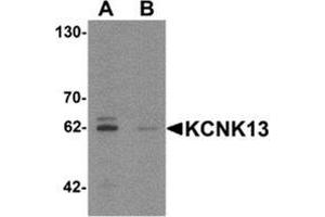 Image no. 2 for anti-Potassium Channel Subfamily K Member 13 (KCNK13) (Middle Region) antibody (ABIN1450040)