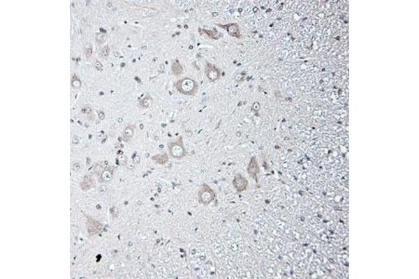 TRPV2 antibody  (AA 700-750)