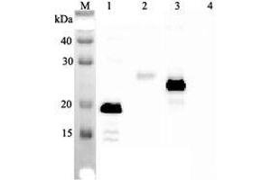 Image no. 1 for anti-Interleukin 33 (IL33) antibody (ABIN1169171)